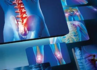 SIMPOZIJ O RANOJ DETEKCIJI OSTEOPOROZE “ULOGA ULTRAZVUČNE DENZITOMETRIJE U RANOM OTKRIVANJU SNIŽENE GUSTOĆE KOSTIJU”